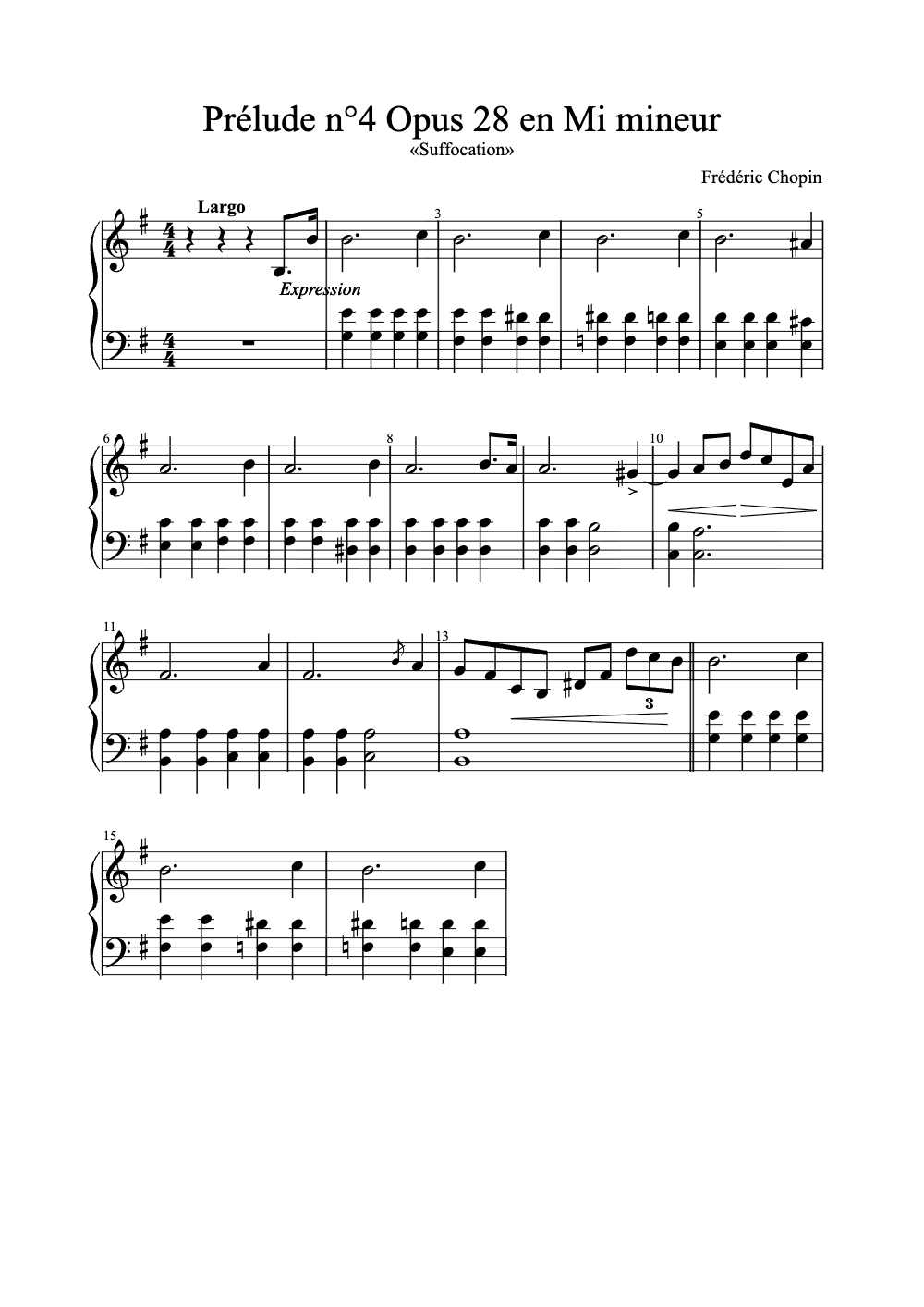 Sheet music preview for Prélude No. 4, Op. 28 in E Minor